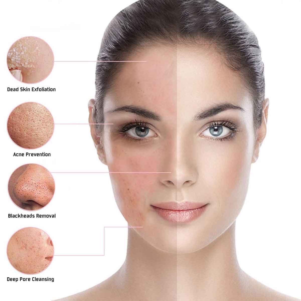 LED Photon Facial Rejuvenator
